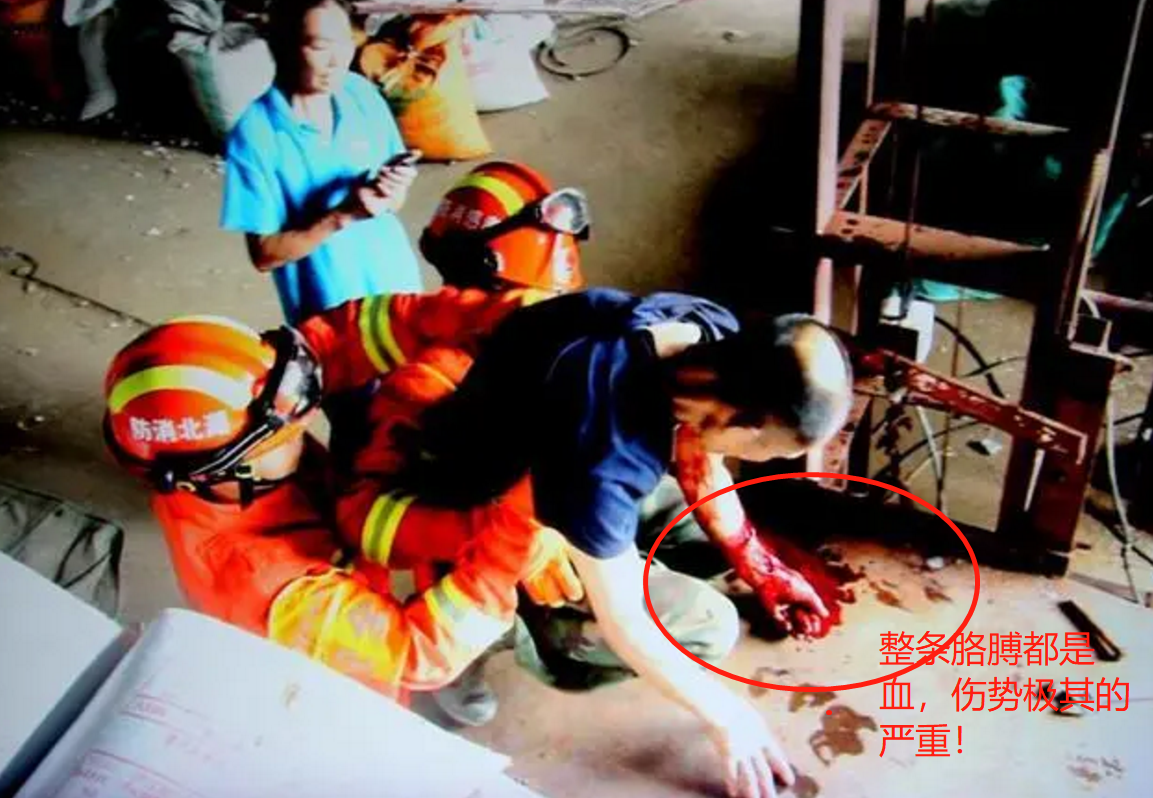 湖北孝感一工人手臂被升降机卡住，现场血流不止，有截肢风险！ 